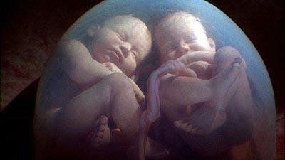 20150127tu-twins-in-the-womb-400x225